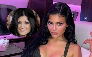 Kylie Jenner niega haberse hecho cirugías para cambiar la apariencia de su rostro