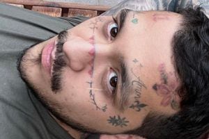 Christian Nodal se somete a una dura técnica para quitarse los tatuajes: Así luce su cara