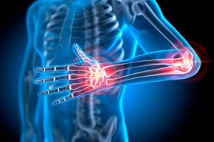 6 prestaciones con Bono PAD para reparar lesiones musculoesqueléticas