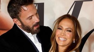 Acusan a Jennifer Lopez de haber obligado a Ben Affleck a “estirarse” la cara