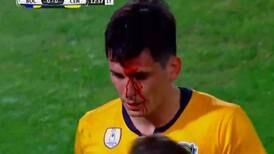Alfonso Parot quedó sangrando tras recibir fuerte golpe en la Superacopa Argentina