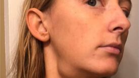 Skincare: Mujer descubre que tiene cáncer haciendo una rutina de belleza