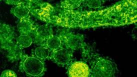 Virus de Marburgo: ¿Cómo se trasmite y cuáles son los síntomas de esta enfermedad similar al Ébola?
