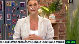 "Se tiñe de negro en señal de luto": La visibilización de Canal 13 contra el femicidio que tristemente debutó en su logo