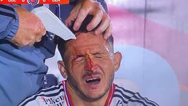 VIDEO | ¡Dolor! La impactante herida que sufrió defensor de Colo Colo y que lo sacó del partido con Rosario Central