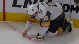 Jugador de hockey esparce sus dientes por el suelo tras recibir discazo