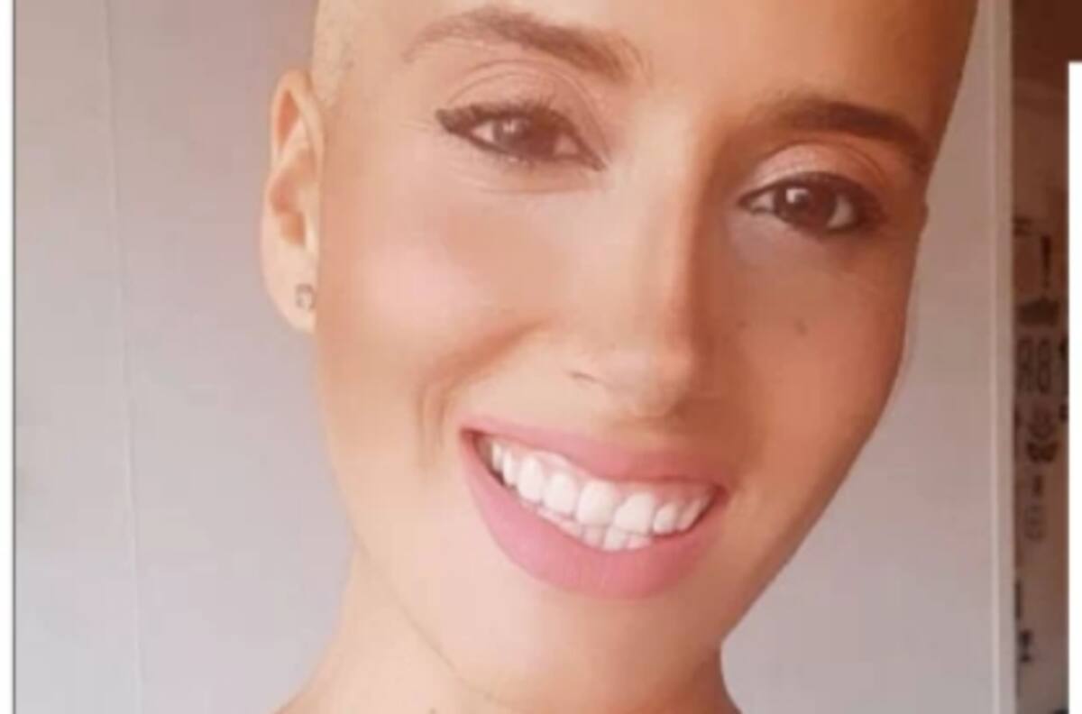 “Estar sin pelo, sin cejas, es superficial”: Mila Correa cuenta cómo enfrenta su cáncer de mamas con un pronóstico no muy favorable