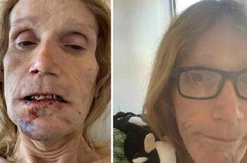 Mujer transgénero denunció haber sido encarcelada con hombres y golpeada por uno de ellos