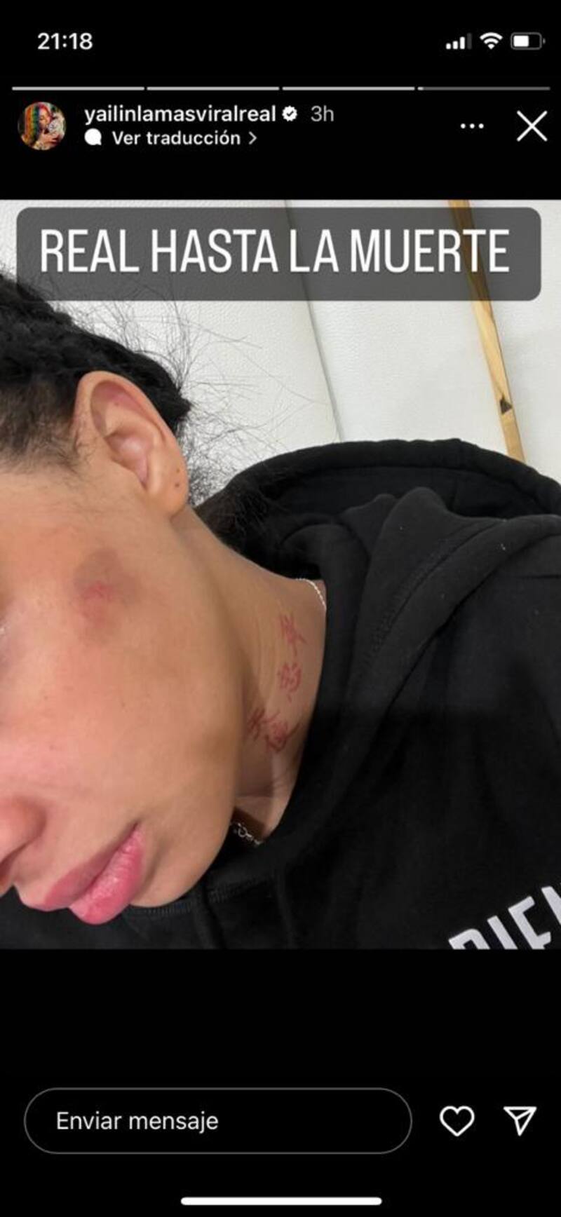 Yailin “La más viral” confirma que Anuel AA la golpeaba
