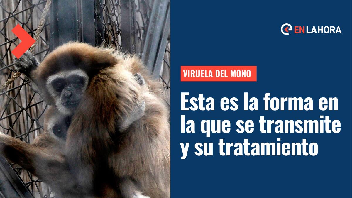 Viruela del Mono: Conoce cómo se transmite la enfermedad y cuál es el tratamiento en caso de contagio