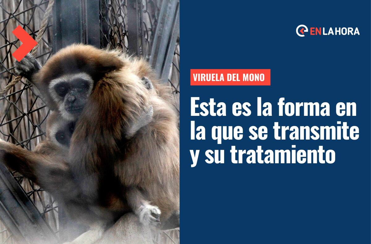 Viruela del Mono: Conoce cómo se transmite la enfermedad y cuál es el tratamiento en caso de contagio