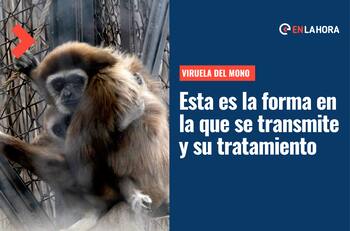 Viruela del Mono: Conoce cómo se transmite la enfermedad y cuál es el tratamiento en caso de contagio