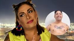 El impactante antes y después de Botota Fox tras someterse a radical cirugía estética