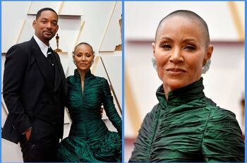 Alopecia areata: La enfermedad que afecta a Jada Pinkett Smith y por la que Will Smith tuvo momento de furia en los Oscar 2022