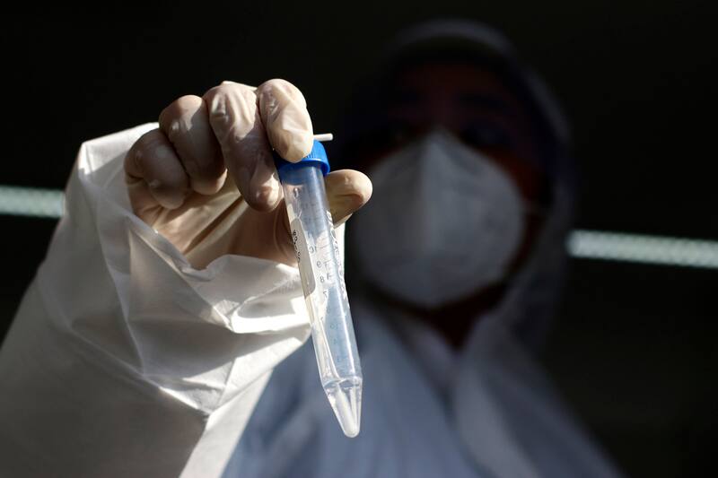 Revisa cuántos casos de covid-19 se reportaron este viernes. Créditos: ATON.