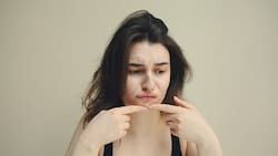 ¿Acné después de los 40? Combátelo con estas mascarillas caseras