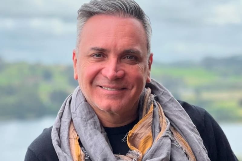 confesó que se implantó pelo. Créditos: Instagram