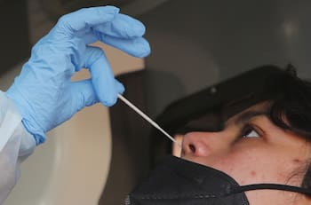 Balance Covid-19: ¿Cuántos casos nuevos y fallecidos se registraron este miércoles 22 de junio?