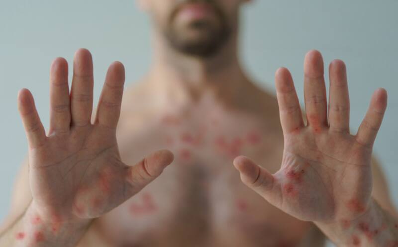 Esta fue la manera en la que la peligrosa variante llegó a Suecia.