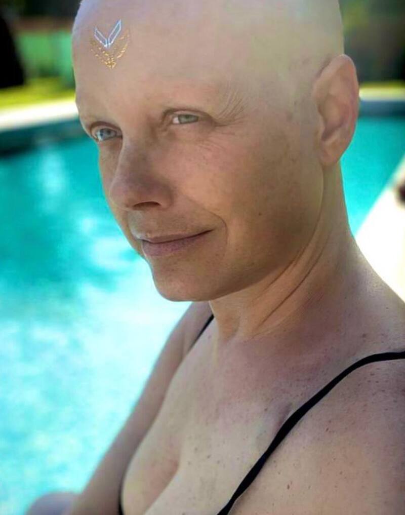 Claudia Conserva hará un documental sobre su lucha contra el cáncer.