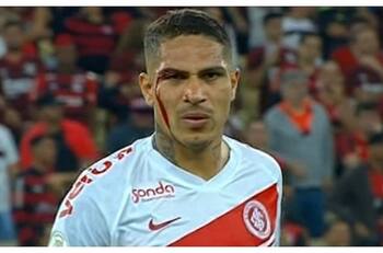 La noche de furia de Paolo Guerrero: Se fue expulsado y terminó con corte en la ceja