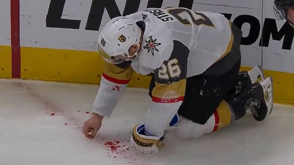 Jugador de hockey esparce sus dientes por el suelo tras recibir discazo