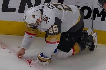 Jugador de hockey esparce sus dientes por el suelo tras recibir discazo