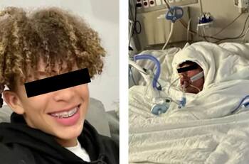 Joven termina desfigurado y con el 75% del cuerpo quemado por reto de TikTok