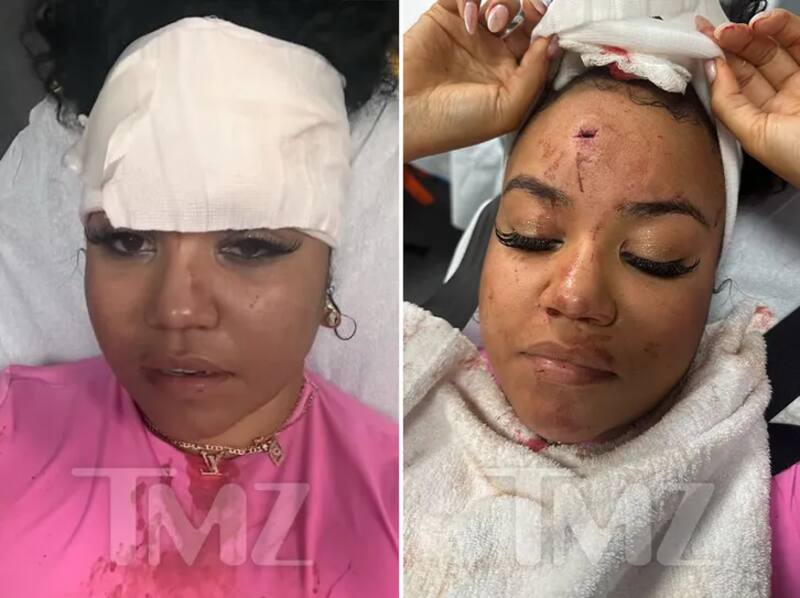 Fanática herida tras momento de ira de 50 Cent. Créditos: TMZ.