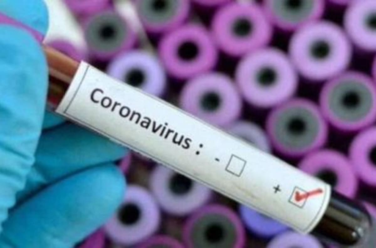 Ministro Mañalich confirmó la muerte de la primera persona por coronavirus en Chile