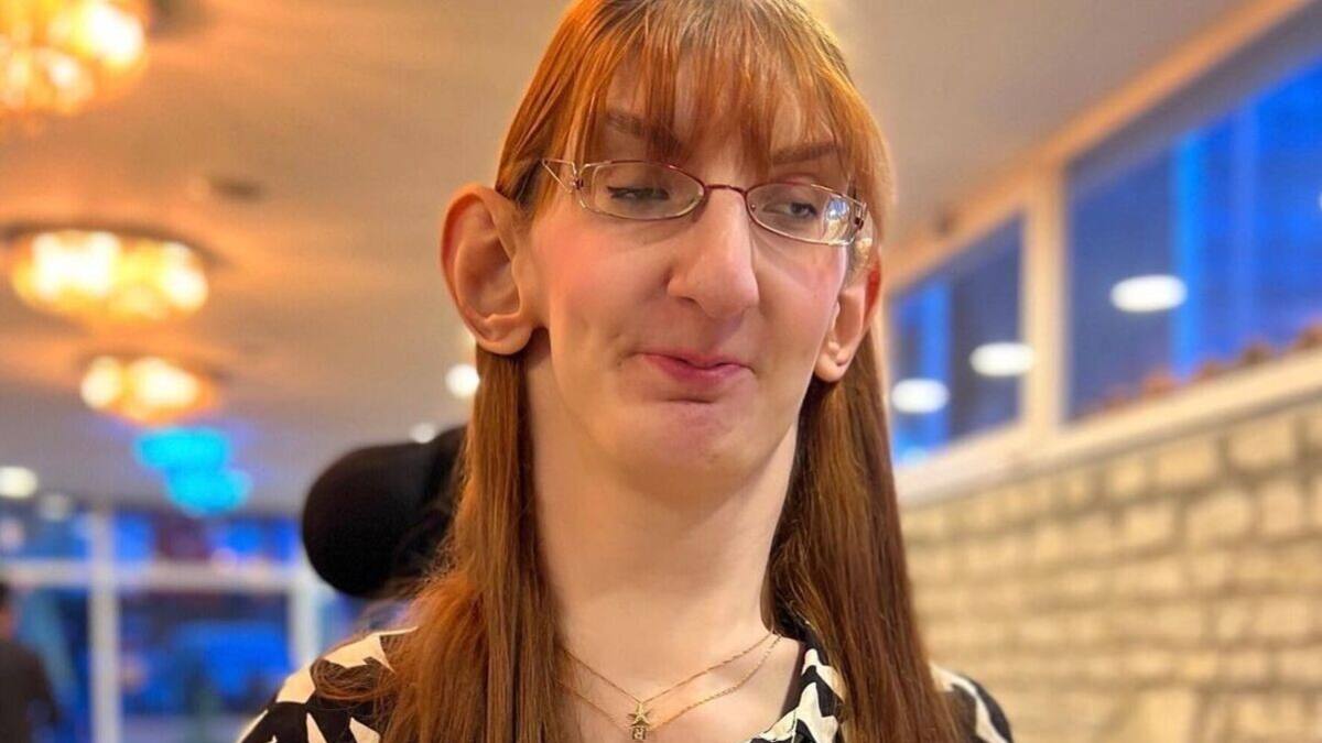 VIDEO | Esta es la mujer con el Récord Guinness por tener las manos más largas del mundo