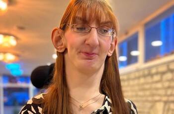 VIDEO | Esta es la mujer con el Récord Guinness por tener las manos más largas del mundo