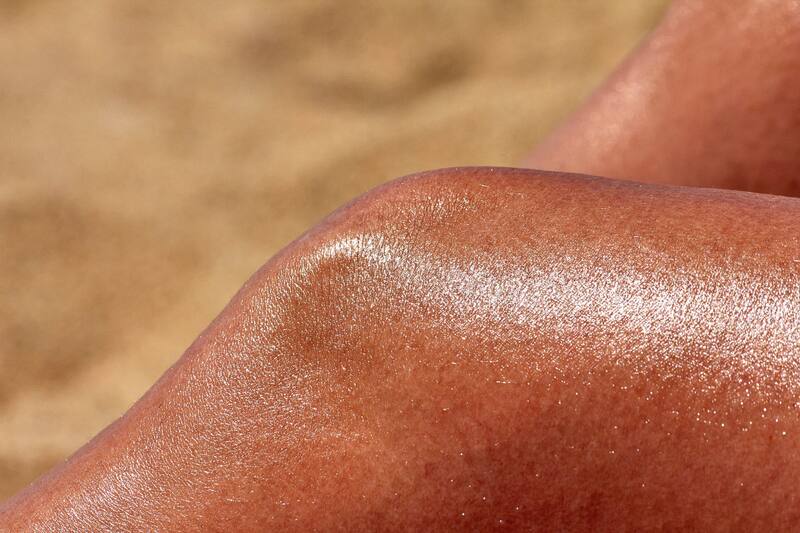 Pasar prolongadas horas bajo el sol sin los cuidados necesarios puede generar lesiones de diversa gravedad. Créditos: Unsplash.