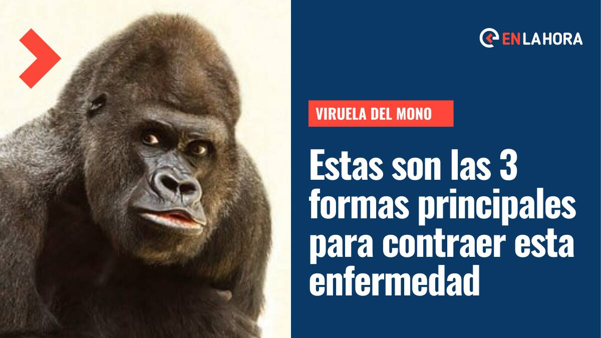 Viruela del Mono: Estas son las 3 principales formar de contagio de esta enfermedad