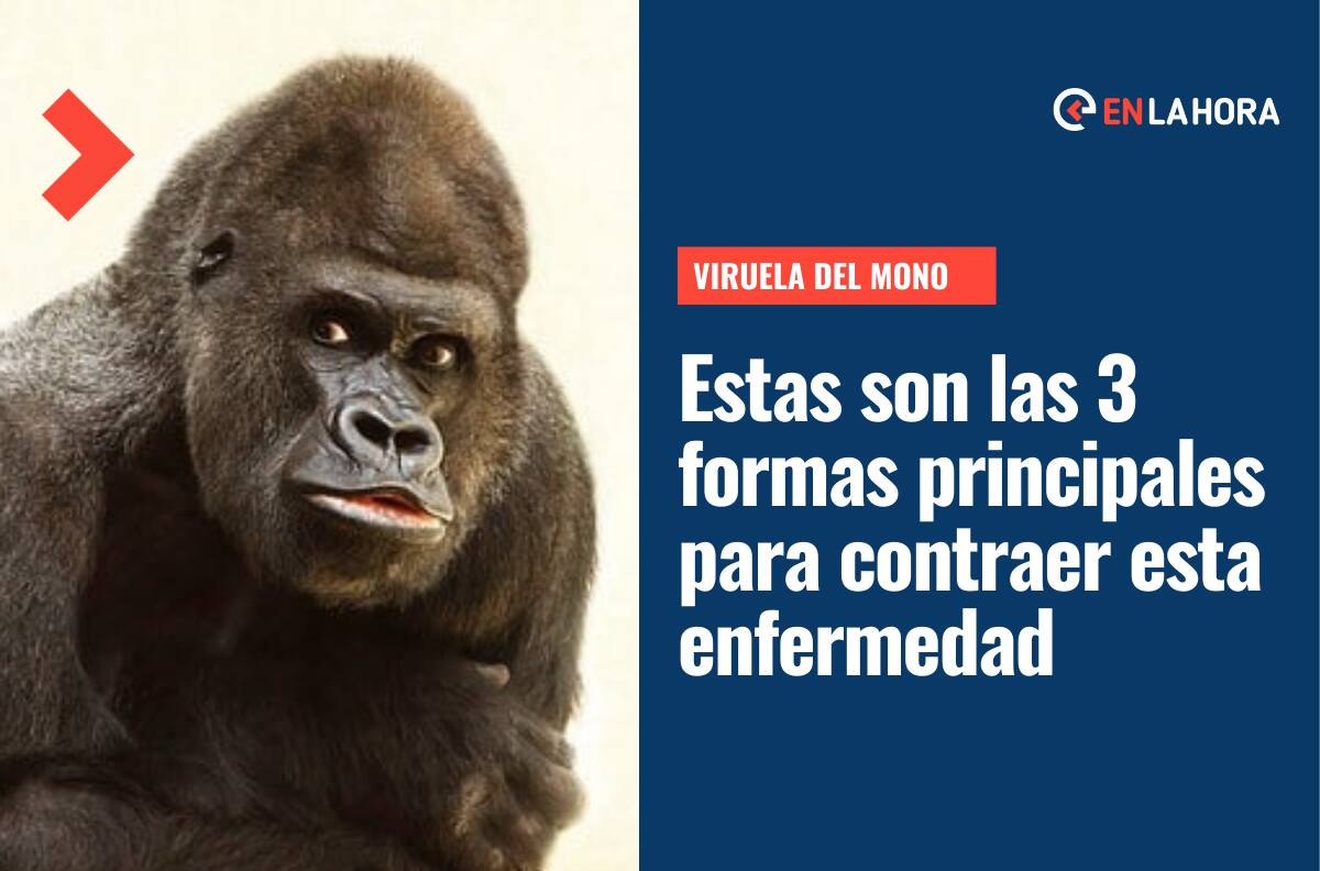 Viruela del Mono: Estas son las 3 principales formar de contagio de esta enfermedad