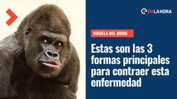 Viruela del Mono: Estas son las 3 principales formar de contagio de esta enfermedad