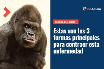 Viruela del Mono: Estas son las 3 principales formar de contagio de esta enfermedad