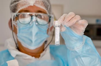 Viruela del Mono: Ministerio de Salud confirma el segundo caso de esta enfermedad en chile