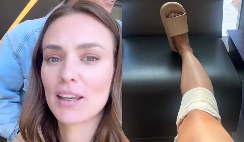 sufrió grave accidente doméstico.