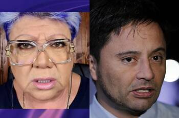 “Se le va a las neuronas y se le paraliza el pensamiento”: Paty Maldonado y Cata Pulido se burlaron de Rodolfo Carter por el uso de bótox