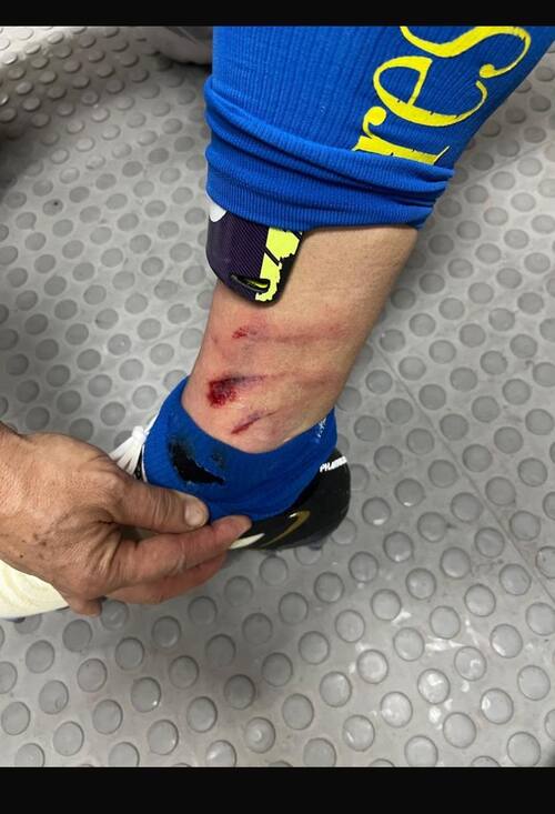 brutal entrada de Quispe