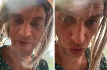 Sheila Devil, hija de Camilo Sesto, impacta por su deterioro físico en incoherente video