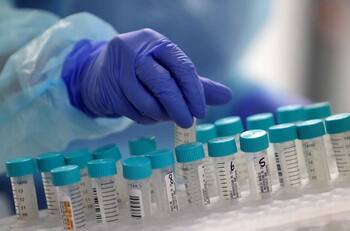 Balance Covid-19: Consulta cuántos casos positivos y fallecimientos reportó el Minsal este jueves 22 de septiembre