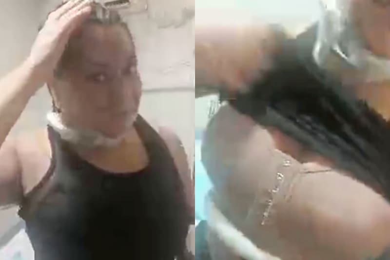 La modelo se sometió a impactante procedimiento estético.