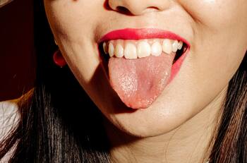 El color de tu lengua puede indicarte si hay problemas en tu salud