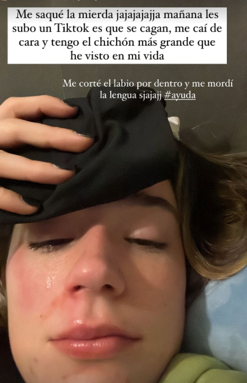 Alessia Traverso se lesionó en su casa y mostró el video en redes sociales.