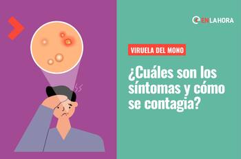 Viruela del mono: ¿Cuáles son sus síntomas y cómo se contagia?