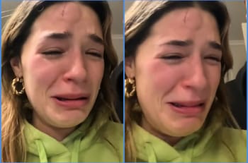 “Es grave”: Alessia Traverso sufrió insólito accidente