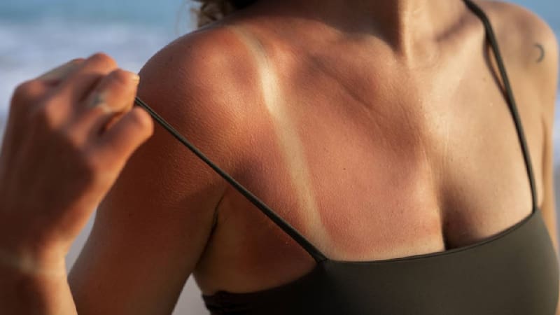 Estos trucos aliviarán tu piel (Foto: Freepik).