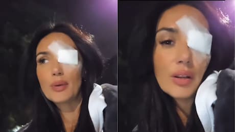 Pamela Díaz impacta tras aparecer en redes sociales con un parche en el ojo: mostró el proceso para advertir a sus seguidores